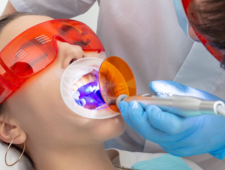 Root Canal