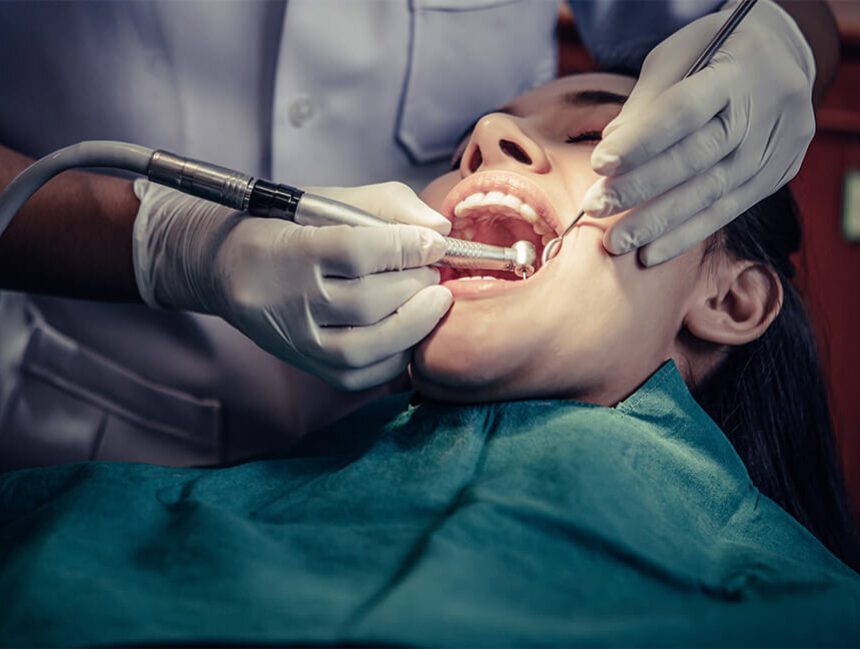 Fillings