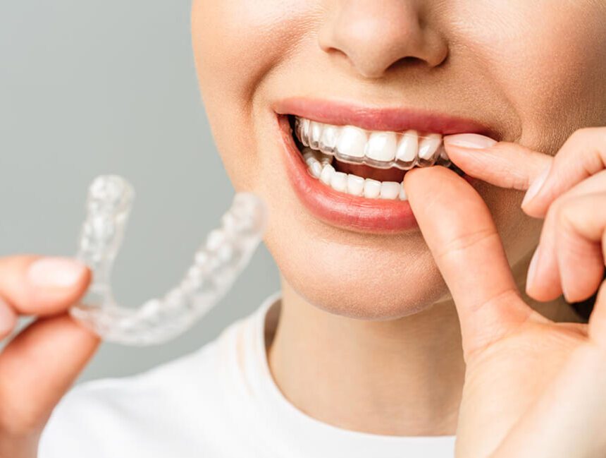 Whitening